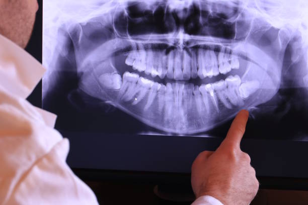 Best Emergency Tooth Extraction in Hampton, AR