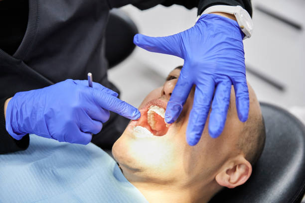 Best Emergency Wisdom Teeth Removal in Hampton, AR